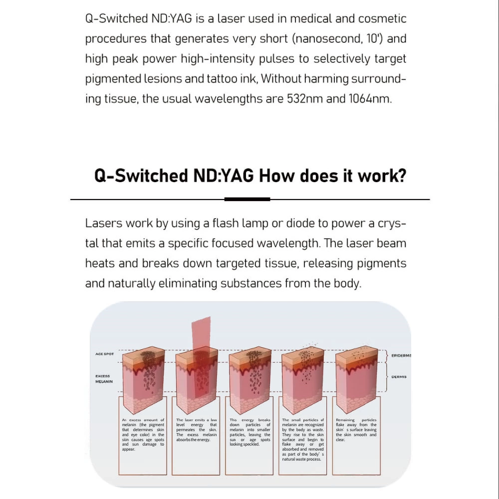 Q-Switched Nd: YAG Laser-Schönheitsmaschine